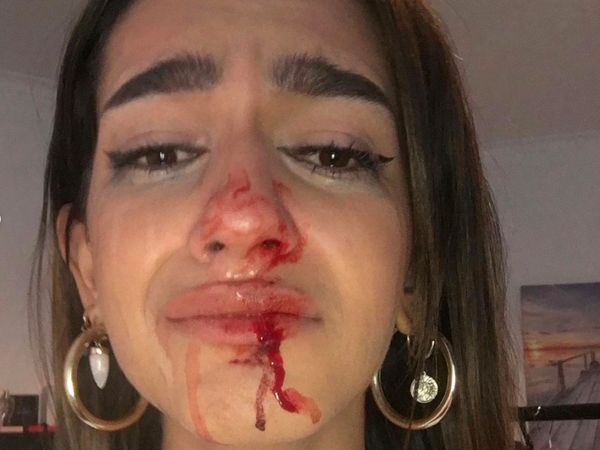 Trans Teen Calls Out Attackers After Day of Remembrance Beating